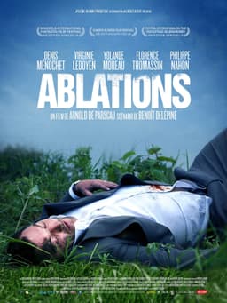 Ablations