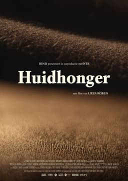 Huidhonger