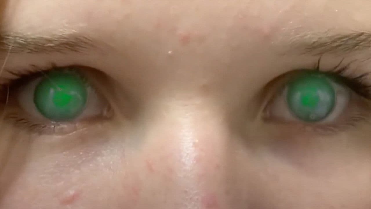 Skittles: No More Games