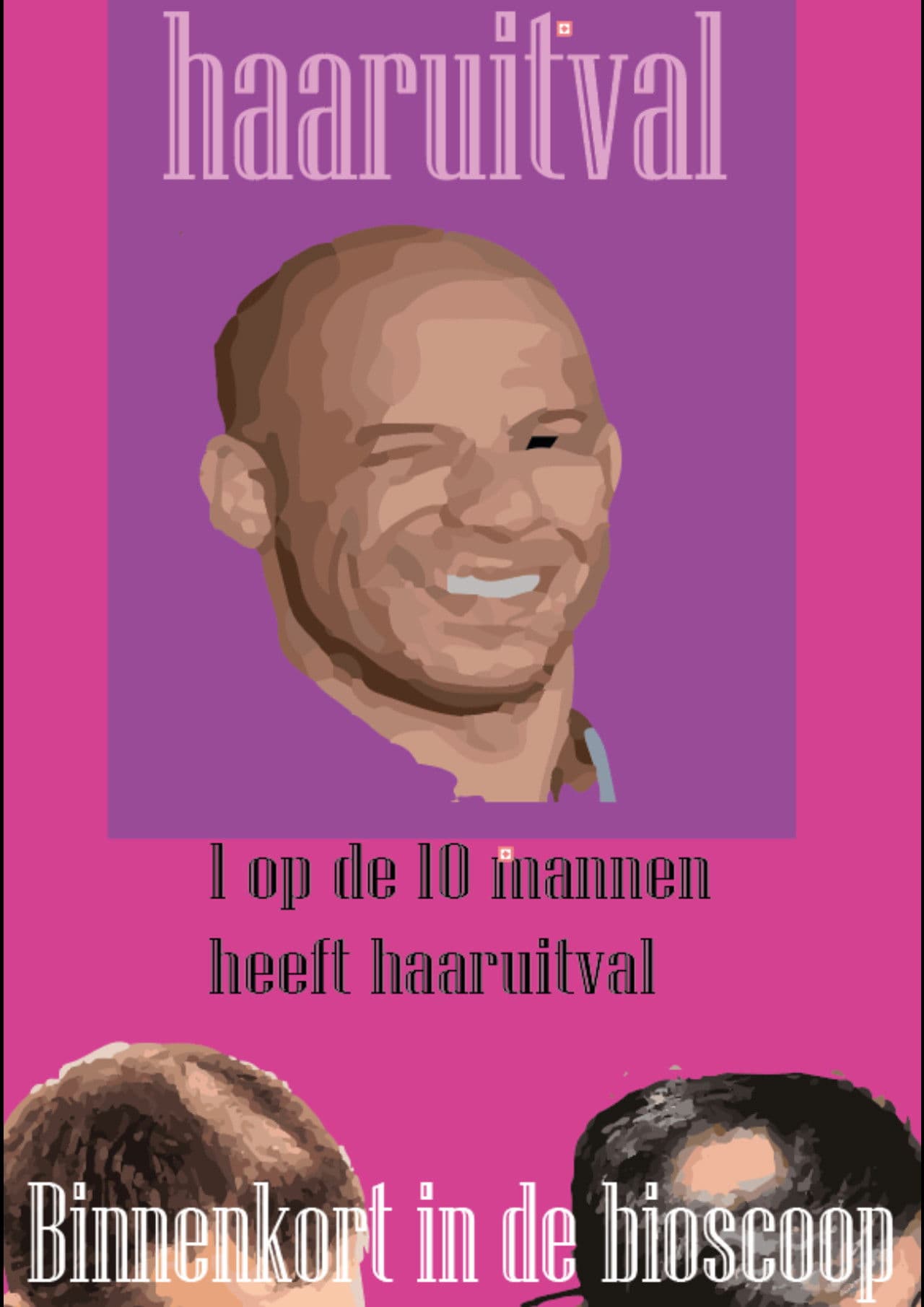 Kaal worden. Wat kan ik doen?